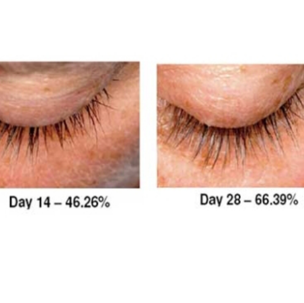 Lashes MD - Picture 2 of 3